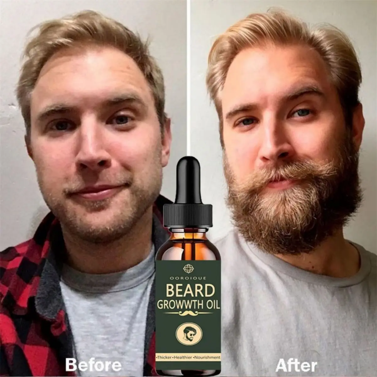 Ingrown Hair Serum - Fast Beard Growth Oil Beard Oil