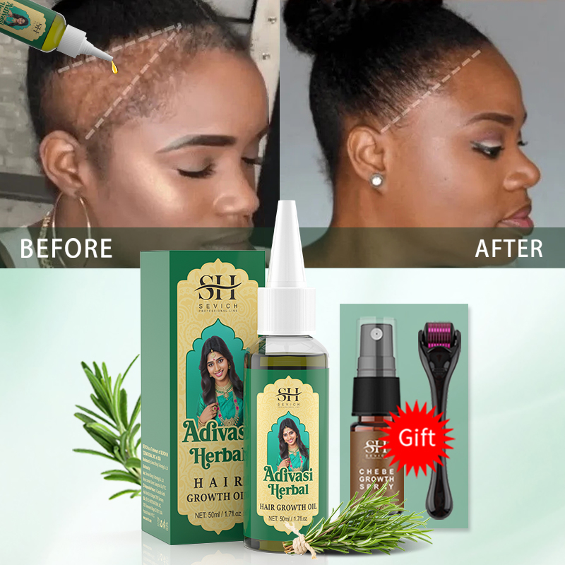 Ayurvedic Hair Growth Oil Indi – Ingrown Hair Serum Bewertung und Preis