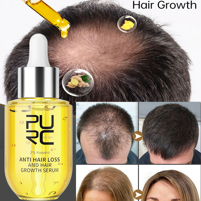 PURC Hair Growth Serum for Men – Ingrown Hair Serum Bewertung und Preis