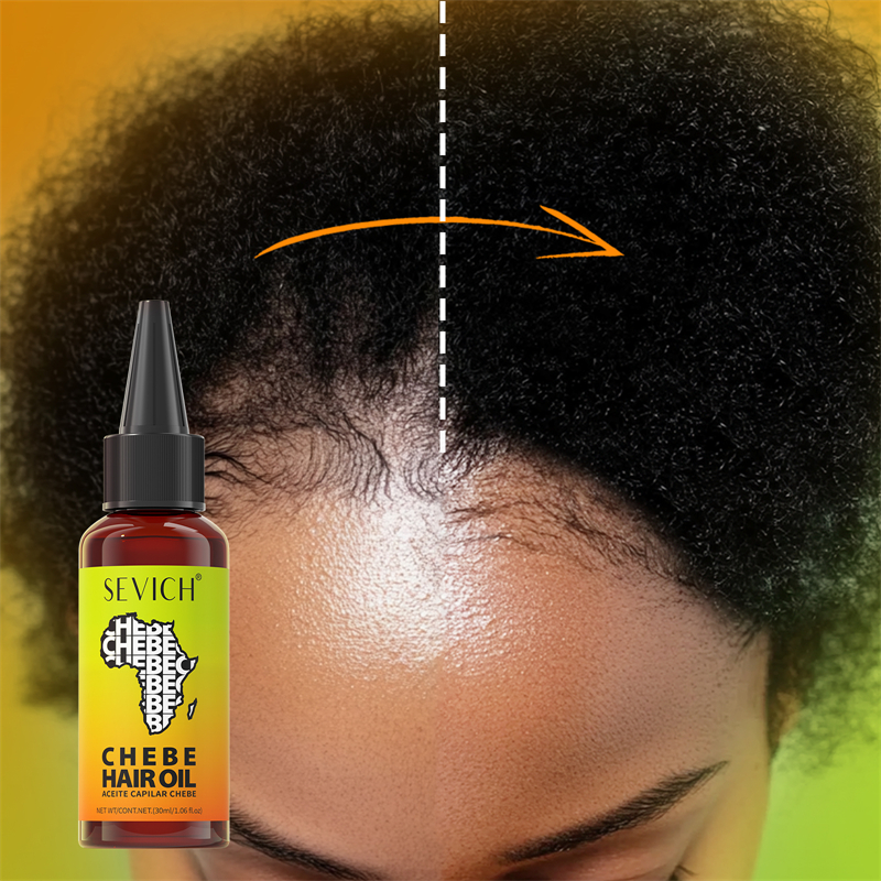 Chebe Fast Hair Growth Oil Afr – Ingrown Hair Serum Bewertung und Preis