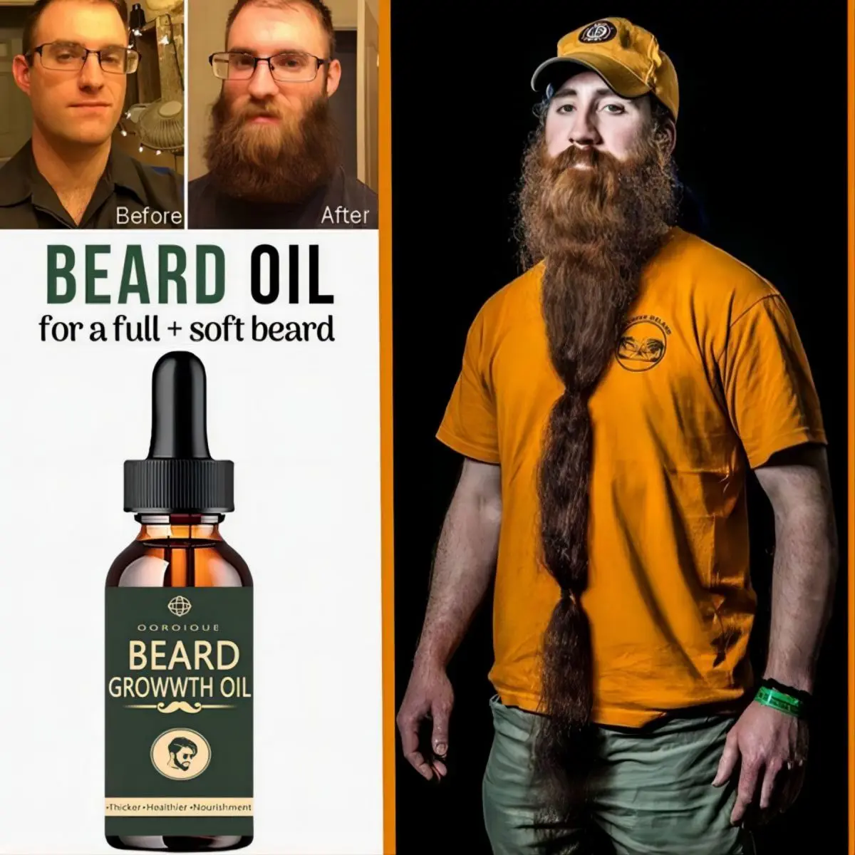 Fast Beard Growth Oil Beard Oi – Ingrown Hair Serum Bewertung und Preis