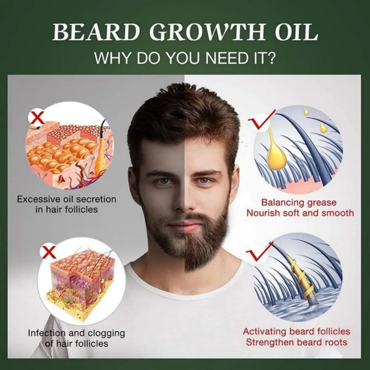 Fast Beard Growth Oil Beard Oi – Ingrown Hair Serum Bewertung und Preis