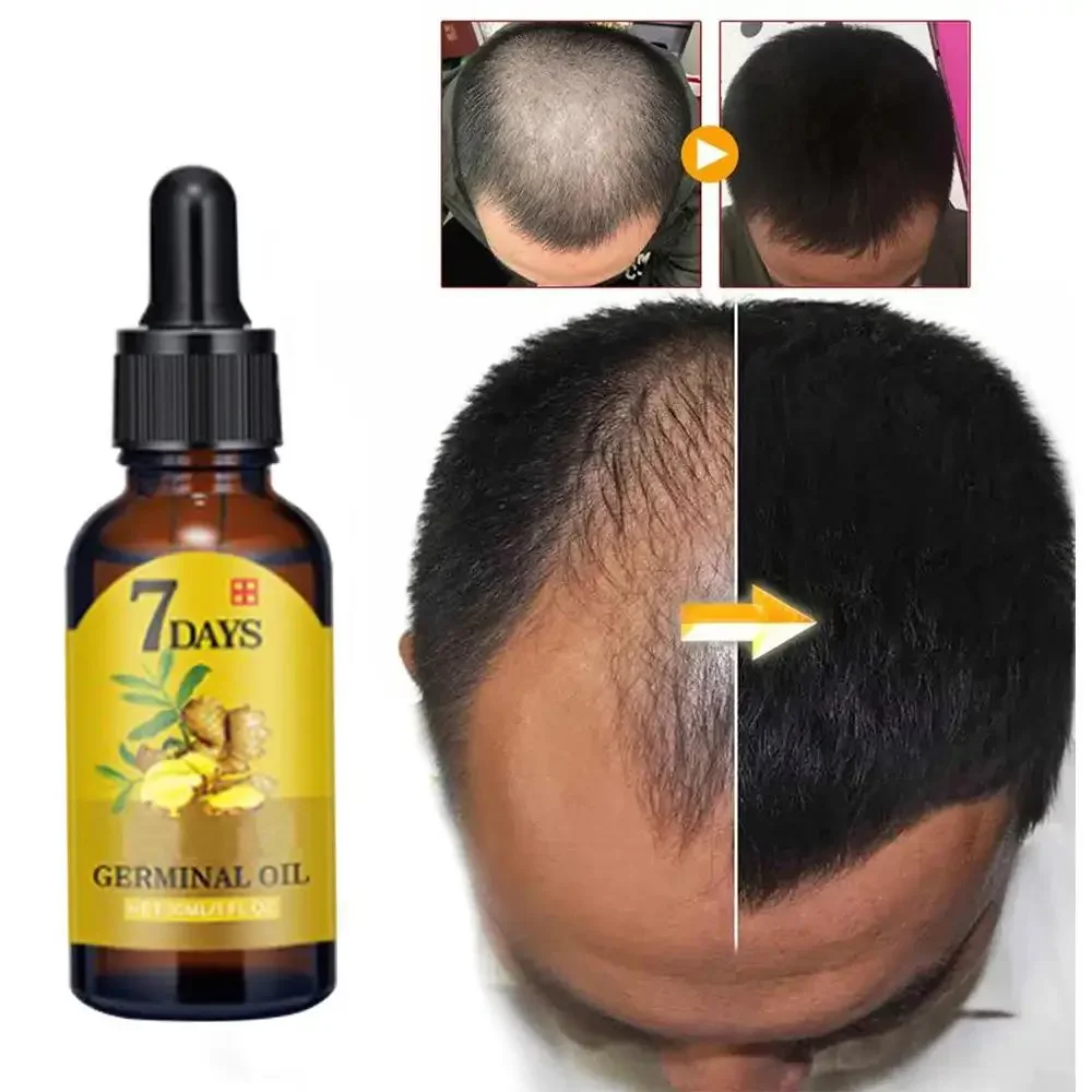 Hair Growth Ginger Fast Growin – Ingrown Hair Serum Bewertung und Preis