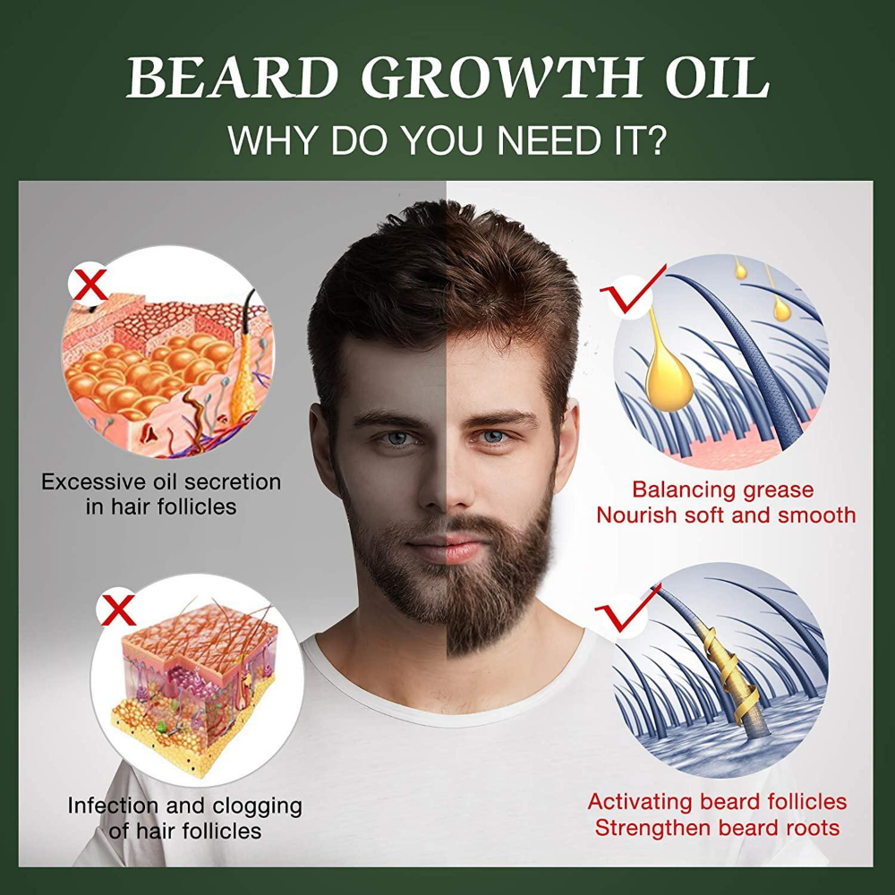 Fast Beard Growth Oil Beard Oi – Ingrown Hair Serum Bewertung und Preis