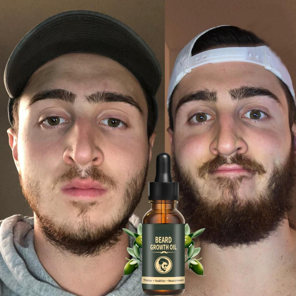 Fast Beard Growth Oil Beard Oi – Ingrown Hair Serum Bewertung und Preis